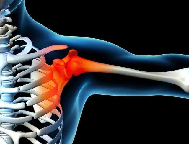 肩周炎能否引起手臂发麻？肩周炎胳膊发麻是什么原因？